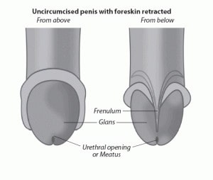 Retracted penis