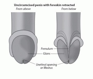 Circumcision Sydney Benefits Risks of Circumcision