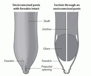 Circumcision Sydney Benefits Risks of Circumcision